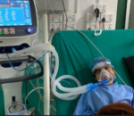 सिवियर निमोनियाका बिरामीको जिल्ला अस्पतालमै सफल उपचार